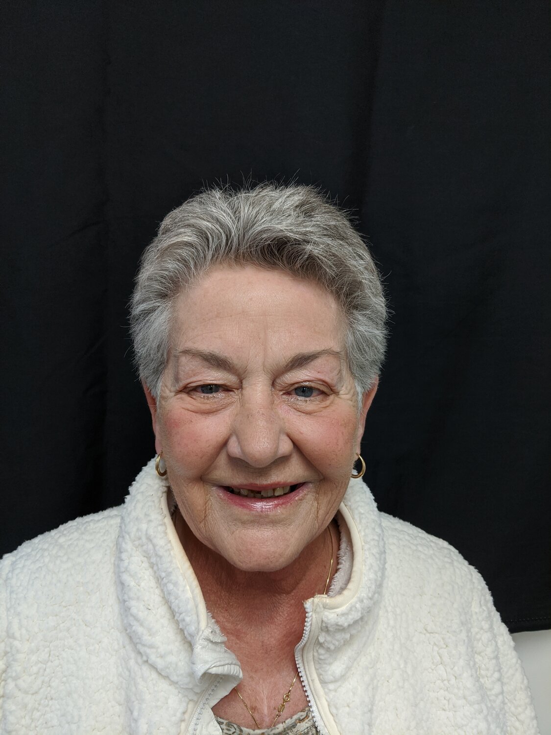 Cathy before cosmetic and restorative dentistry with Dr. Rauch