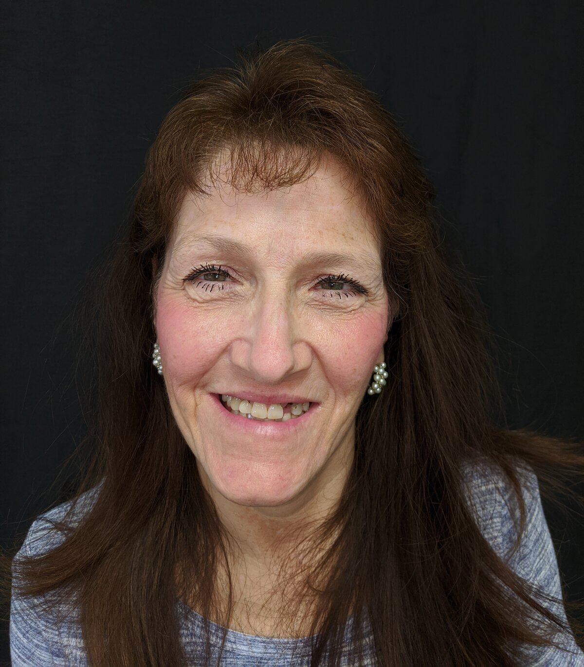 Gina before smile transformation with Dr. Rauch