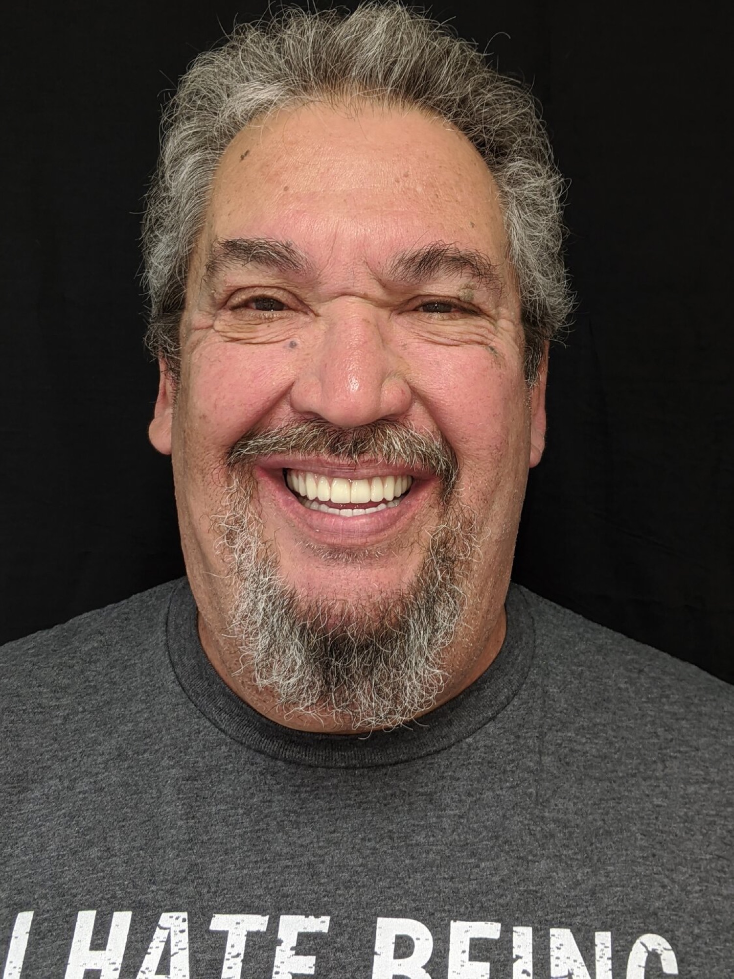 Michael after full-mouth implant restoration with Dr. Rauch